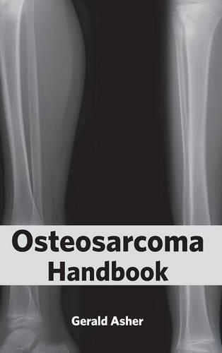 Cover image for Osteosarcoma Handbook