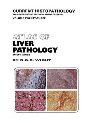 Cover image for Atlas of Liver Pathology