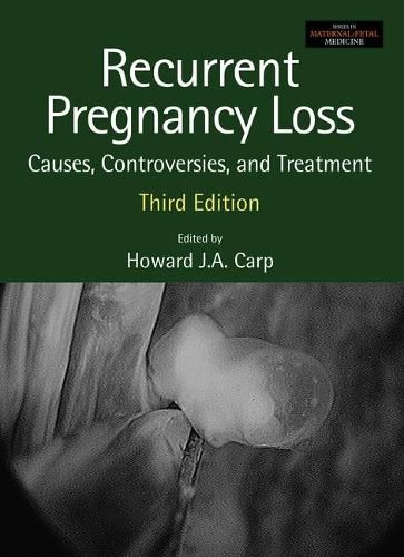 Cover image for Recurrent Pregnancy Loss: Causes, Controversies, and Treatment