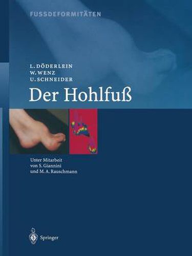 Cover image for Fussdeformitaten: Der Hohlfuss