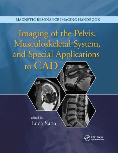 Cover image for Imaging of the Pelvis, Musculoskeletal System, and Special Applications to CAD