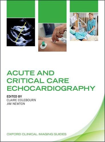 Cover image for Acute and Critical Care Echocardiography