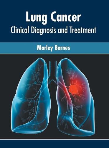 Cover image for Lung Cancer: Clinical Diagnosis and Treatment