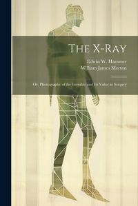 Cover image for The X-Ray; Or, Photography of the Invisible and Its Value in Surgery