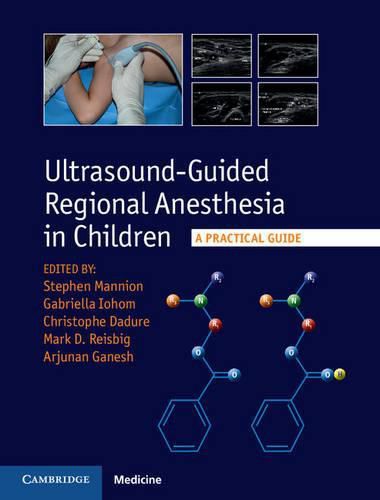 Cover image for Ultrasound-Guided Regional Anesthesia in Children: A Practical Guide