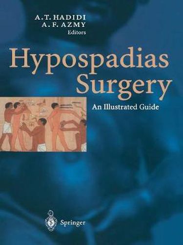 Cover image for Hypospadias Surgery: An Illustrated Guide