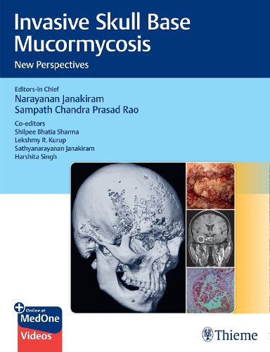 Cover image for Invasive Skull Base Mucormycosis