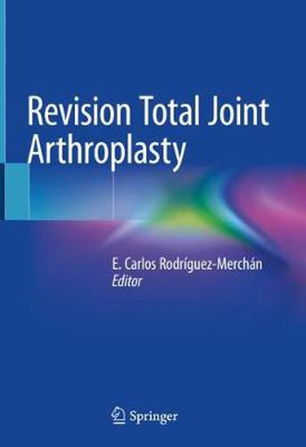 Cover image for Revision Total Joint Arthroplasty