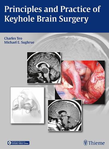 Cover image for Principles and Practice of Keyhole Brain Surgery