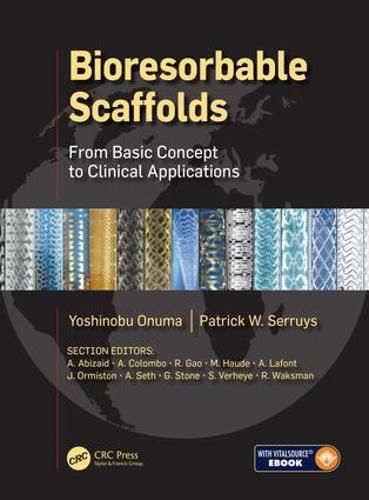 Cover image for Bioresorbable Scaffolds: From Basic Concept to Clinical Applications