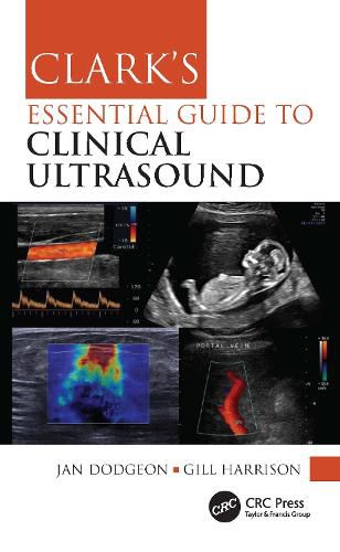 Cover image for Clark's Essential Guide to Clinical Ultrasound