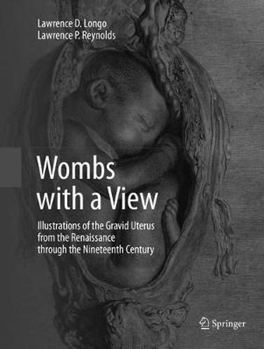 Wombs with a View: Illustrations of the Gravid Uterus from the Renaissance through the Nineteenth Century