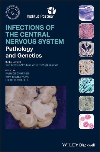 Infections of the Central Nervous System - Pathology and Genetics