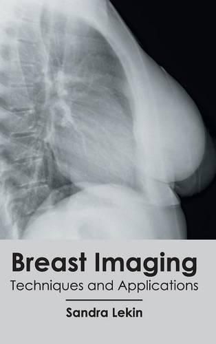 Cover image for Breast Imaging: Techniques and Applications