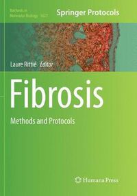 Cover image for Fibrosis: Methods and Protocols