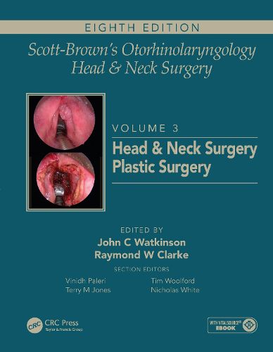 Head & Neck Surgery Plastic Surgery: Volume 3: Head and Neck Surgery, Plastic Surgery