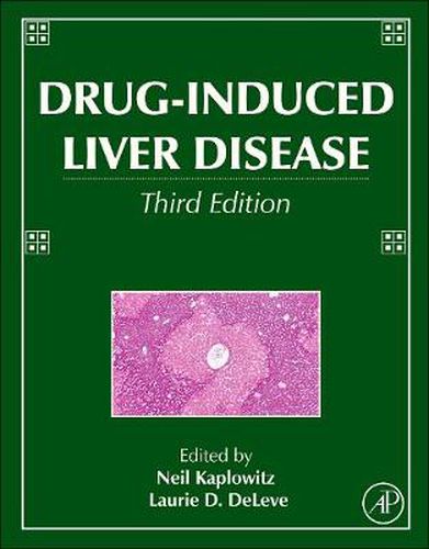 Cover image for Drug-Induced Liver Disease
