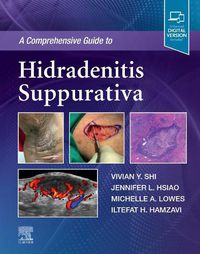 Cover image for A Comprehensive Guide to Hidradenitis Suppurativa