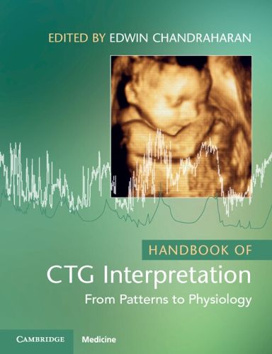 Cover image for Handbook of CTG Interpretation