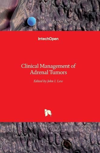 Cover image for Clinical Management of Adrenal Tumors