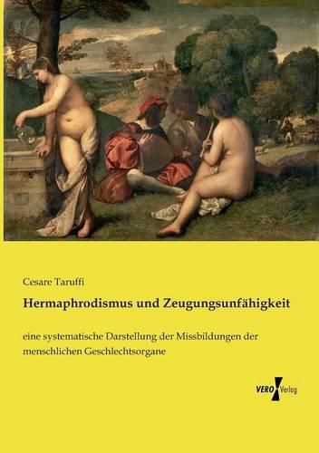 Cover image for Hermaphrodismus und Zeugungsunfahigkeit: eine systematische Darstellung der Missbildungen der menschlichen Geschlechtsorgane