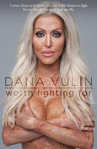 Cover image for Worth Fighting For