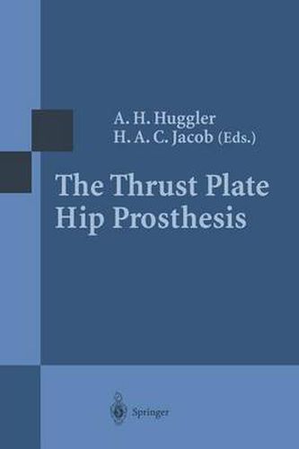 Cover image for The Thrust Plate Hip Prosthesis