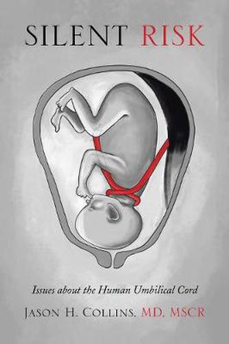 Cover image for Silent Risk: Issues about the Human Umbilical Cord