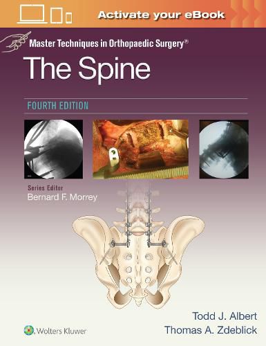 Cover image for Master Techniques in Orthopaedic Surgery: The Spine