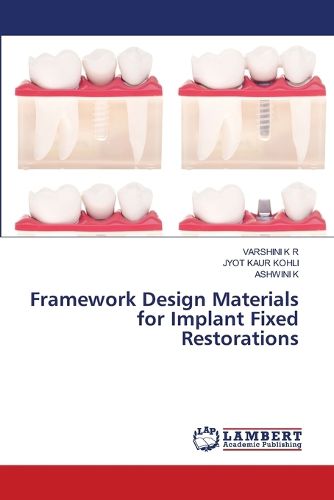 Cover image for Framework Design Materials for Implant Fixed Restorations