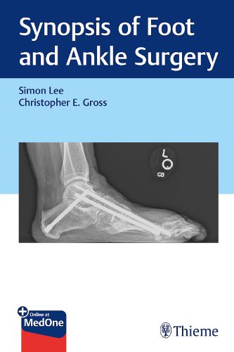 Cover image for Synopsis of Foot and Ankle Surgery