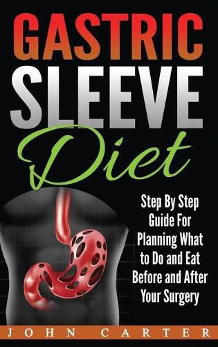 Gastric Sleeve Diet: Step By Step Guide For Planning What to Do and Eat Before and After Your Surgery