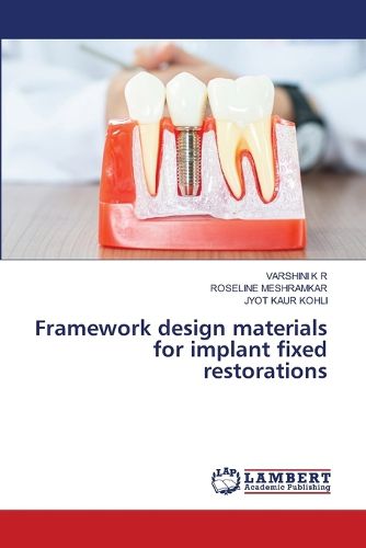 Cover image for Framework design materials for implant fixed restorations