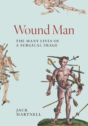 Cover image for Wound Man