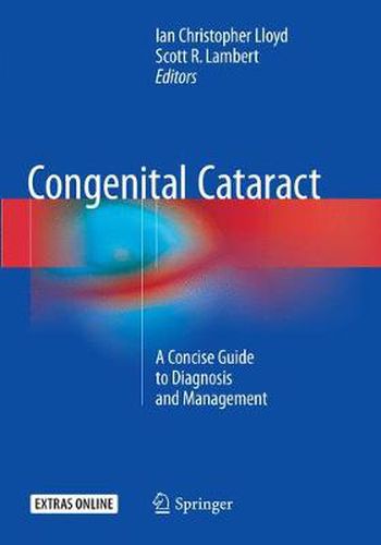 Congenital Cataract: A Concise Guide to Diagnosis and Management