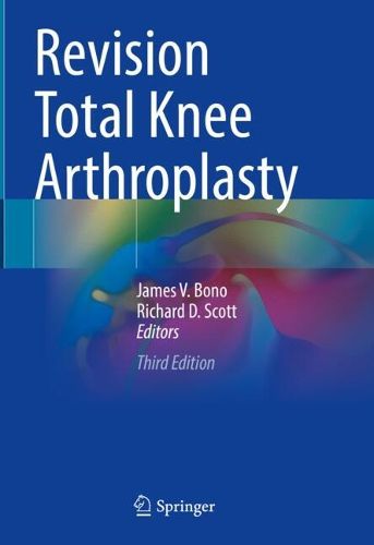 Cover image for Revision Total Knee Arthroplasty
