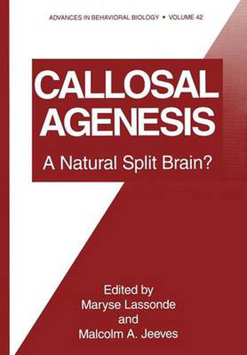 Cover image for Callosal Agenesis: A Natural Split Brain?