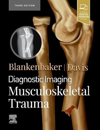 Cover image for Diagnostic Imaging: Musculoskeletal Trauma