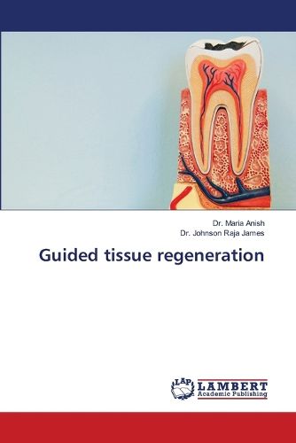 Cover image for Guided tissue regeneration