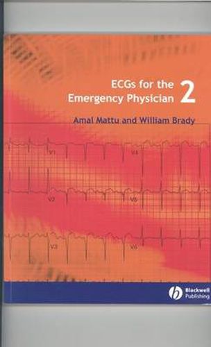 Cover image for ECGs for the Emergency Physician