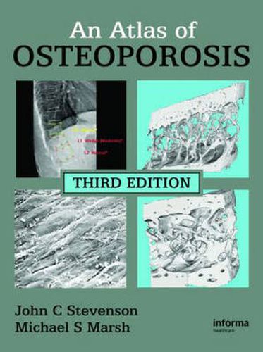 Cover image for An Atlas of Osteoporosis