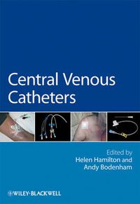 Cover image for Central Venous Catheters