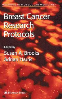 Cover image for Breast Cancer Research Protocols