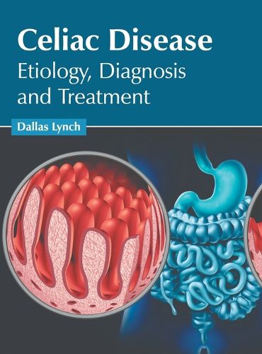 Cover image for Celiac Disease: Etiology, Diagnosis and Treatment