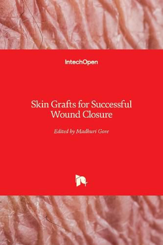 Cover image for Skin Grafts for Successful Wound Closure