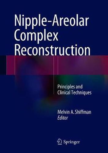 Cover image for Nipple-Areolar Complex Reconstruction: Principles and Clinical Techniques