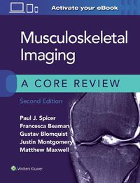 Cover image for Musculoskeletal Imaging: A Core Review