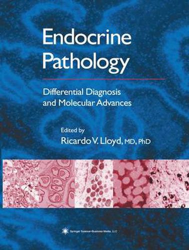 Endocrine Pathology: Differential Diagnosis and Molecular Advances