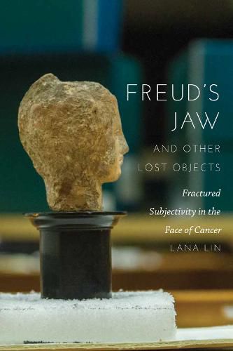 Cover image for Freud's Jaw and Other Lost Objects: Fractured Subjectivity in the Face of Cancer