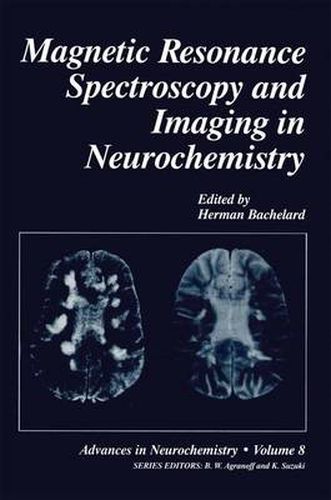 Cover image for Magnetic Resonance Spectroscopy and Imaging in Neurochemistry